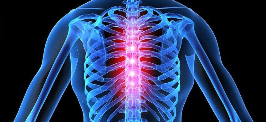 Akútna bolesť je charakteristická pre exacerbáciu osteochondrózy hrudnej chrbtice