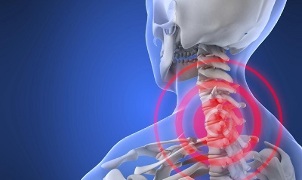 príčiny cervikálnej osteochondrózy