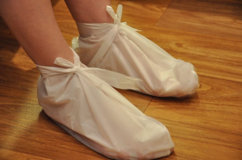 obklady na artrózu členku