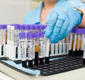 krvný test na diagnostiku bolesti kĺbov