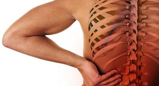 ako sa prejavuje osteochondróza bedrovej chrbtice