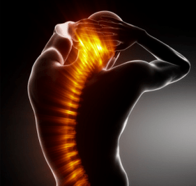 osteochondróza je ochorenie chrbtice