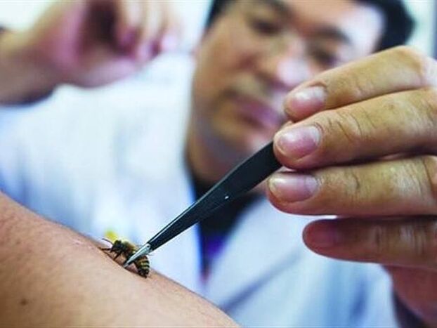 apiterapia cervikálnej osteochondrózy